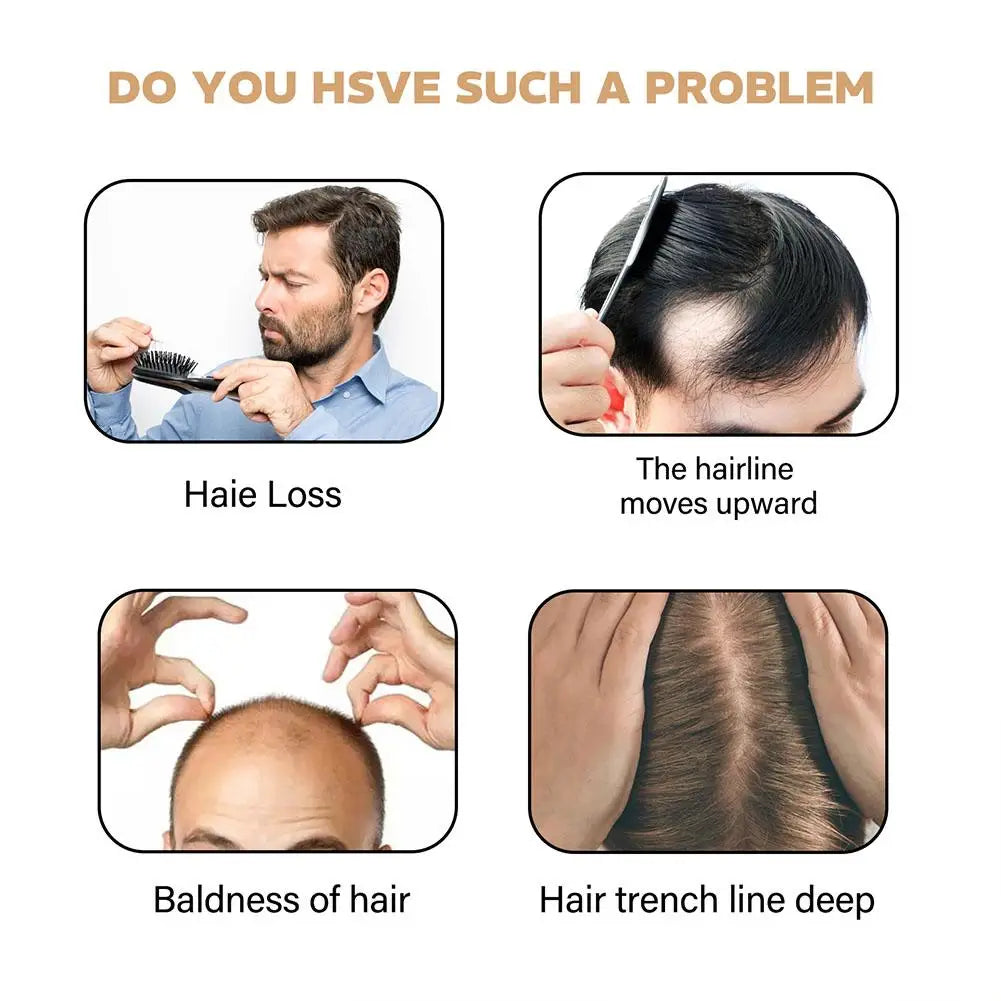 Shampooing de traitement contre la perte de cheveux