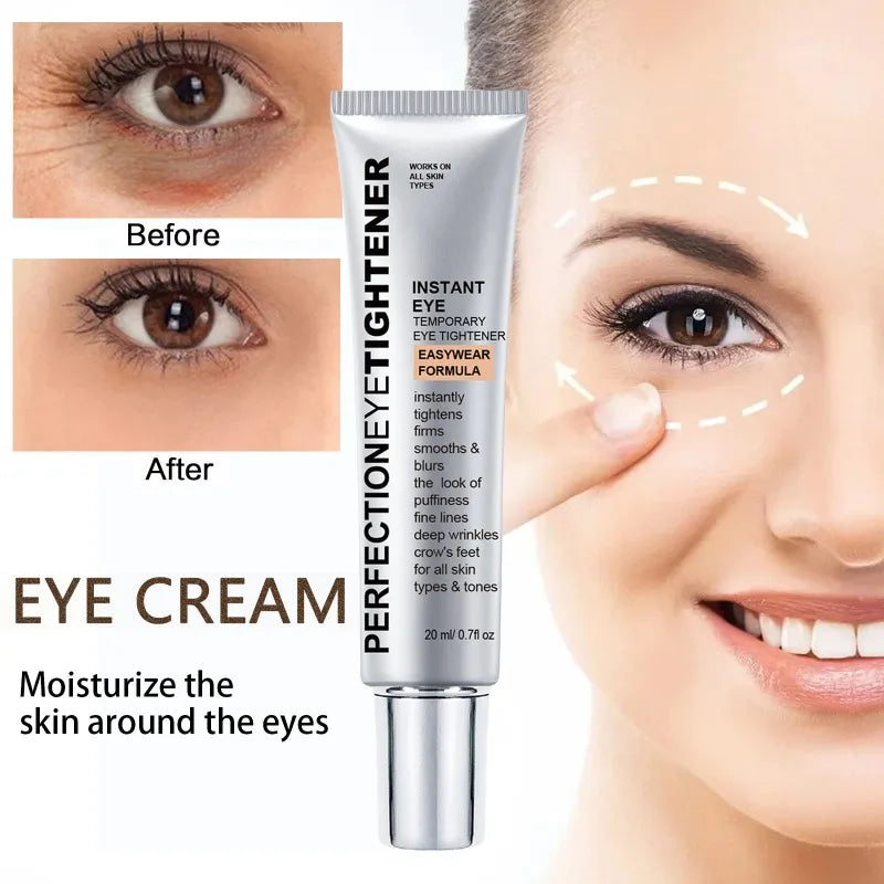 Eye Cream Removes Dark Circles Tightens The Eyes Lifting Firming And Removing Eye Bags Make Your Eyes More Lively