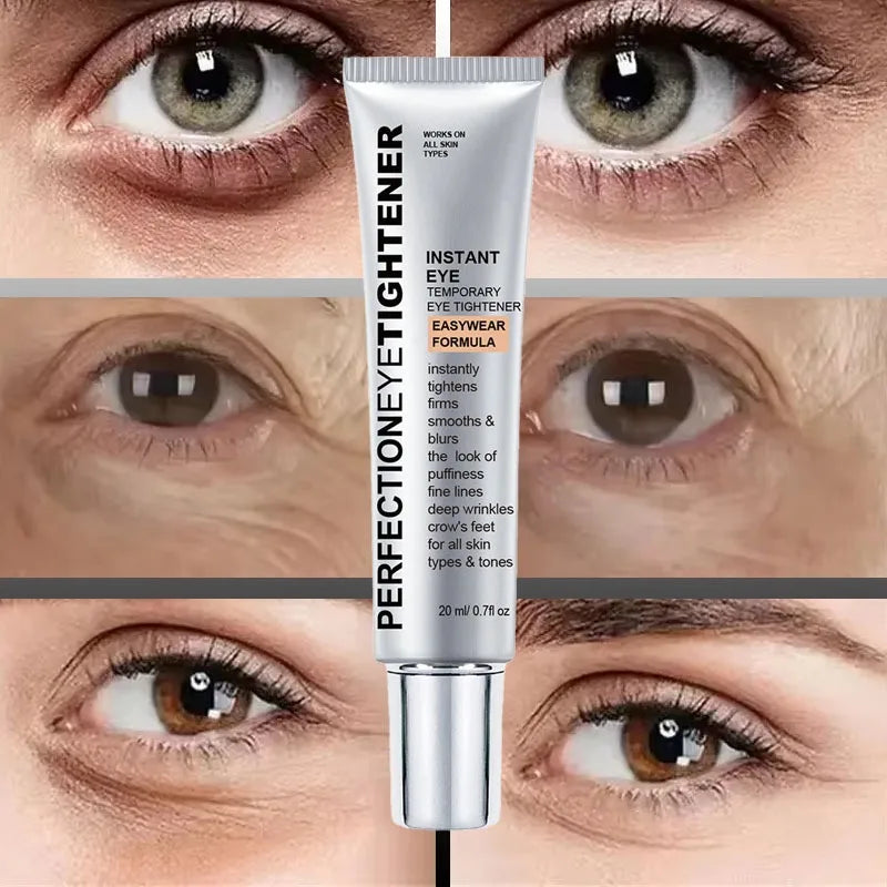 Eye Cream Removes Dark Circles Tightens The Eyes Lifting Firming And Removing Eye Bags Make Your Eyes More Lively