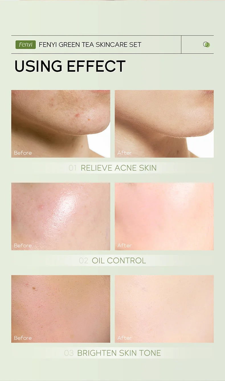 19pcs Gift Box Kit Green Tea Skin Rejuvenation Face Essence Korean Face Cream Fade Dark Circles Eye Cream Skin Care Products