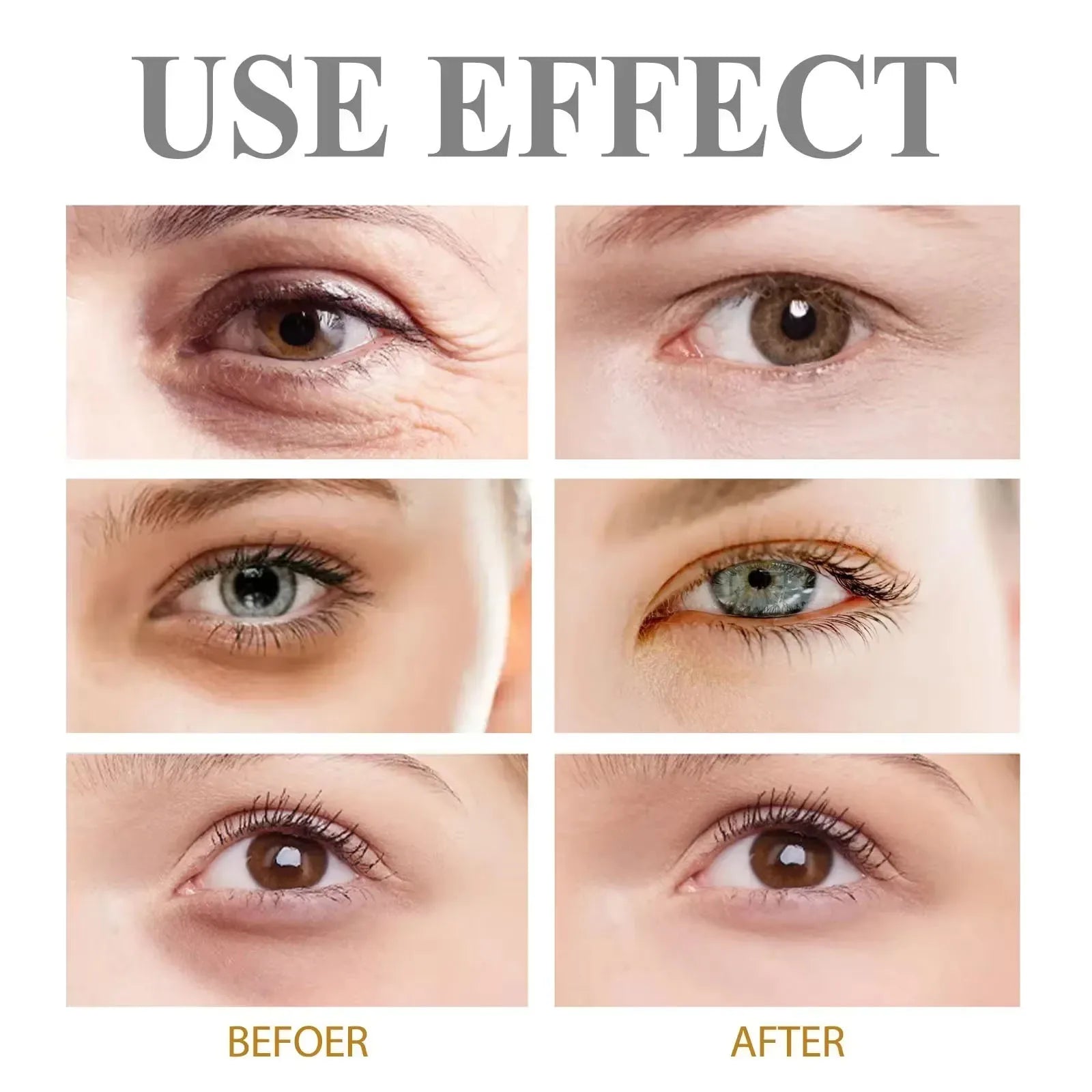 Eye Cream Removes Dark Circles Tightens The Eyes Lifting Firming And Removing Eye Bags Make Your Eyes More Lively