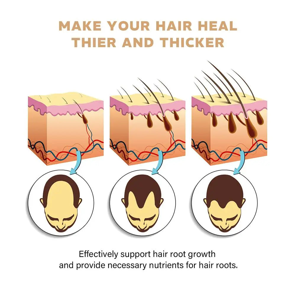 Shampooing de traitement contre la perte de cheveux