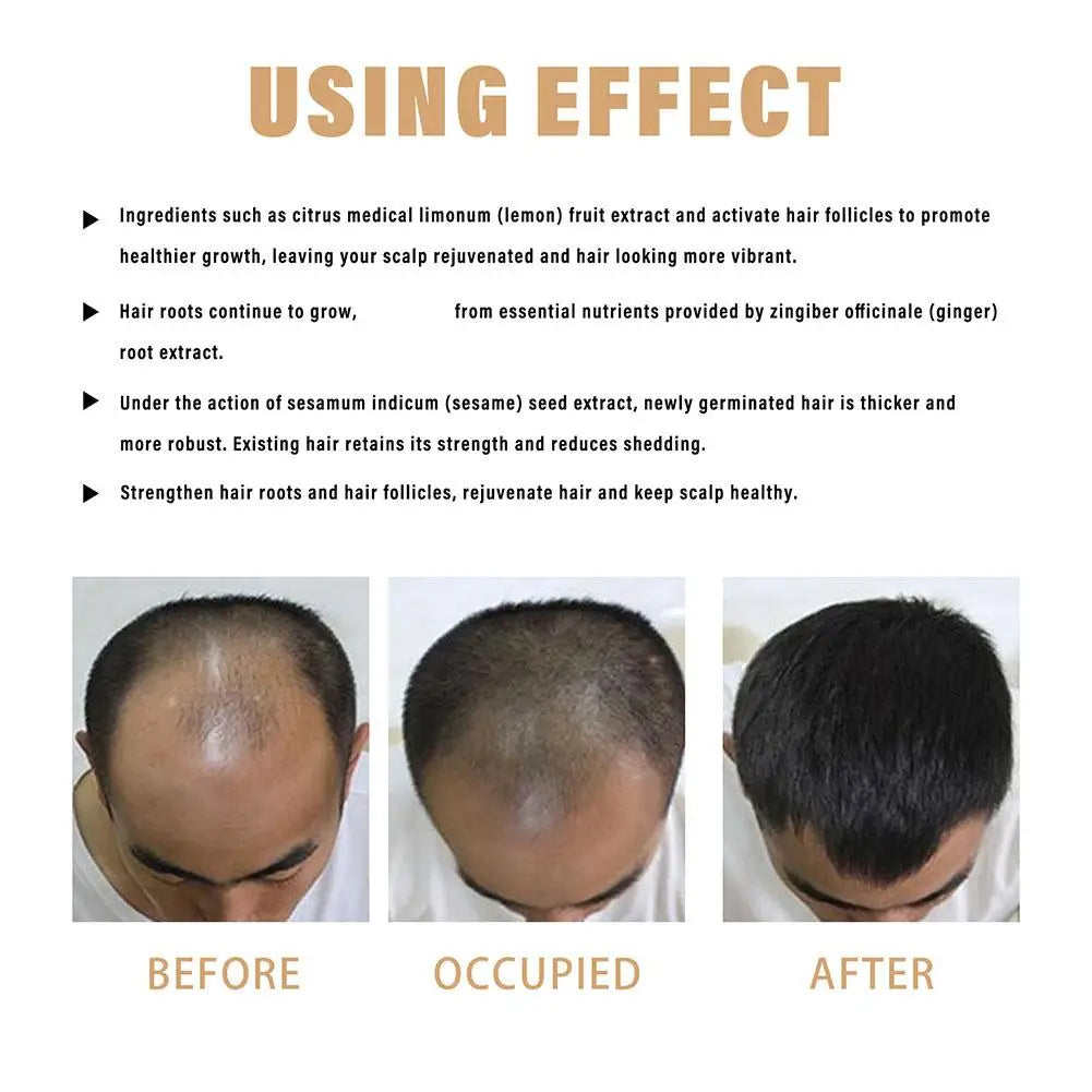 Shampooing de traitement contre la perte de cheveux